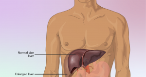 Menjaga Kesehatan Hati dengan Pola Makan Sehat: Rahasia Merawat Organ Penting Tubuh