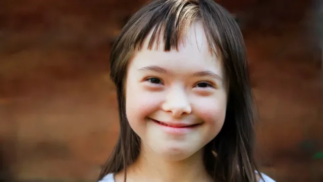 Memahami Konstipasi pada Anak Down Syndrome: Penyebab, Gejala, dan Penanganannya